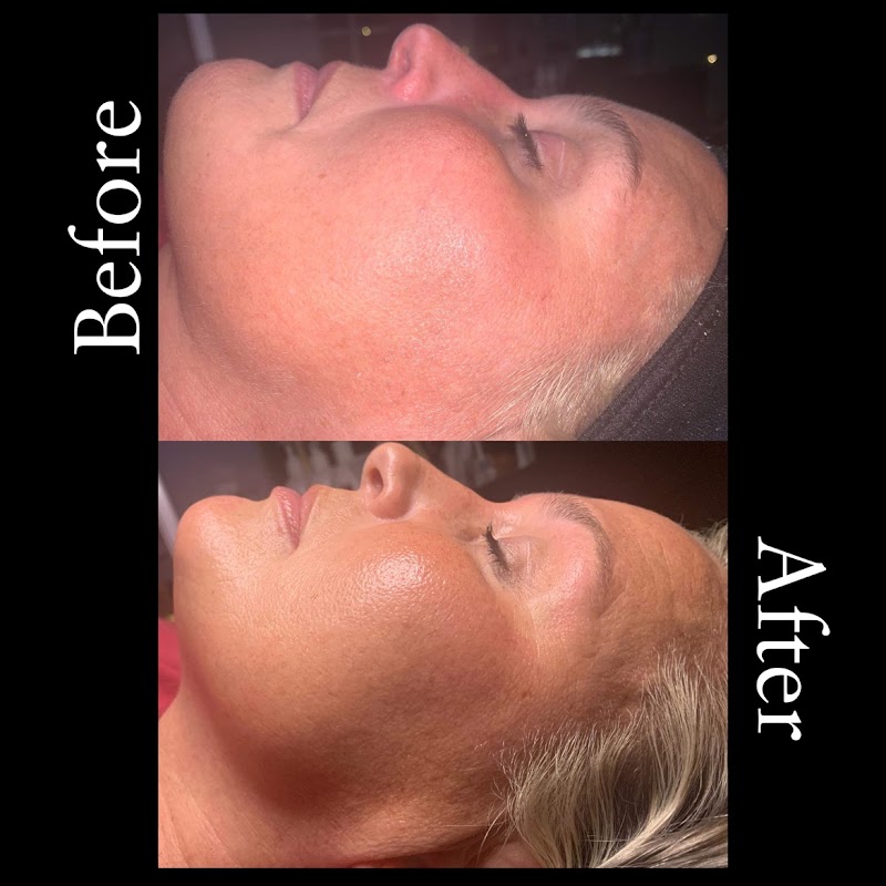 JustSkin with Rachel, spa in Gadsden, AL, photo 1 of 10